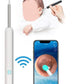 Smart Earwax Removal Kit 👂 HD Visual Ear Cleaner with Camera