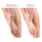 Electric Pedicure Foot File & Callus Remover — Rechargeable 2-Speed Foot Care Device